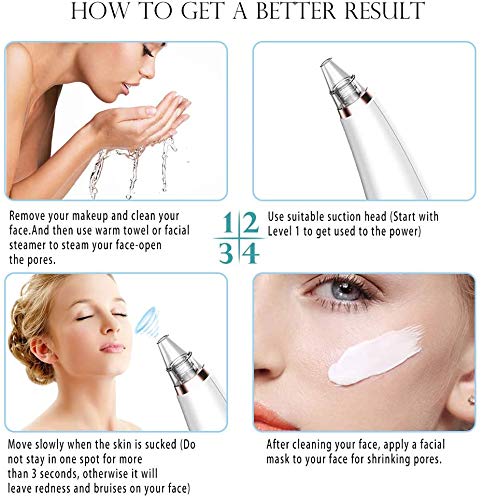 Blackhead Remover