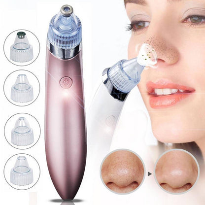 Blackhead Remover